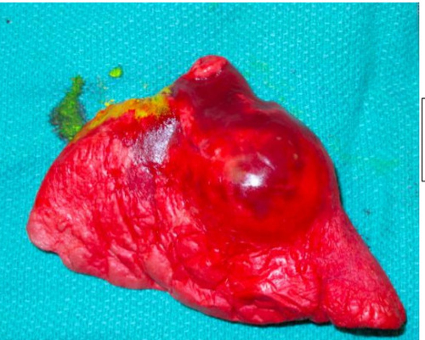 <p>What is pattern of distribution?</p>