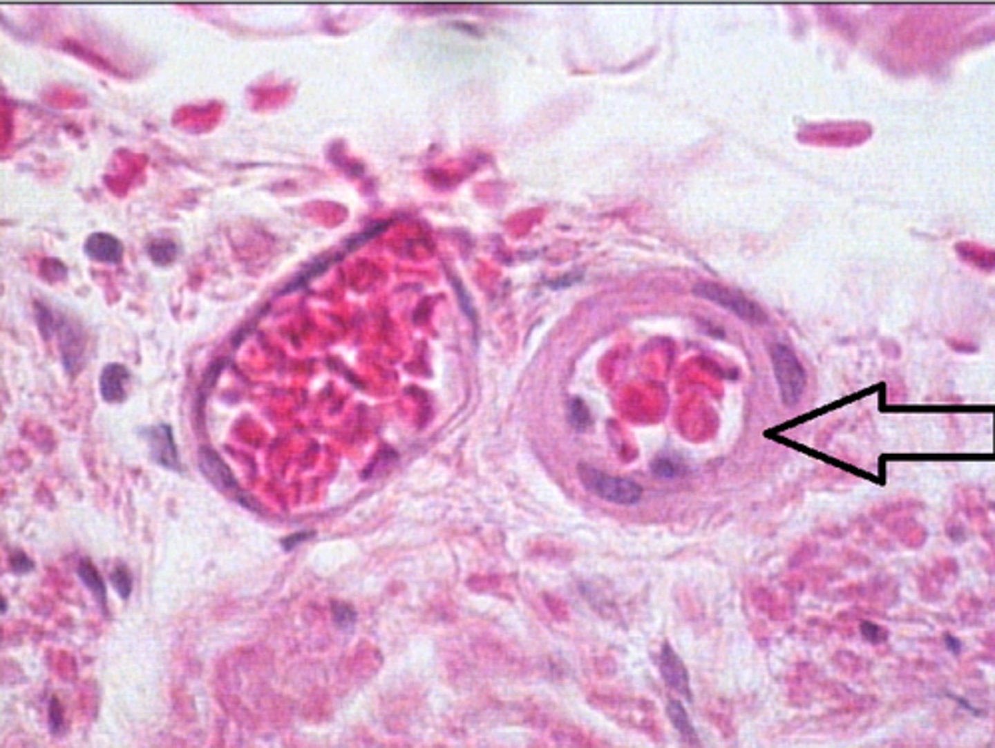 <p>Identify the structure at the arrow?</p>