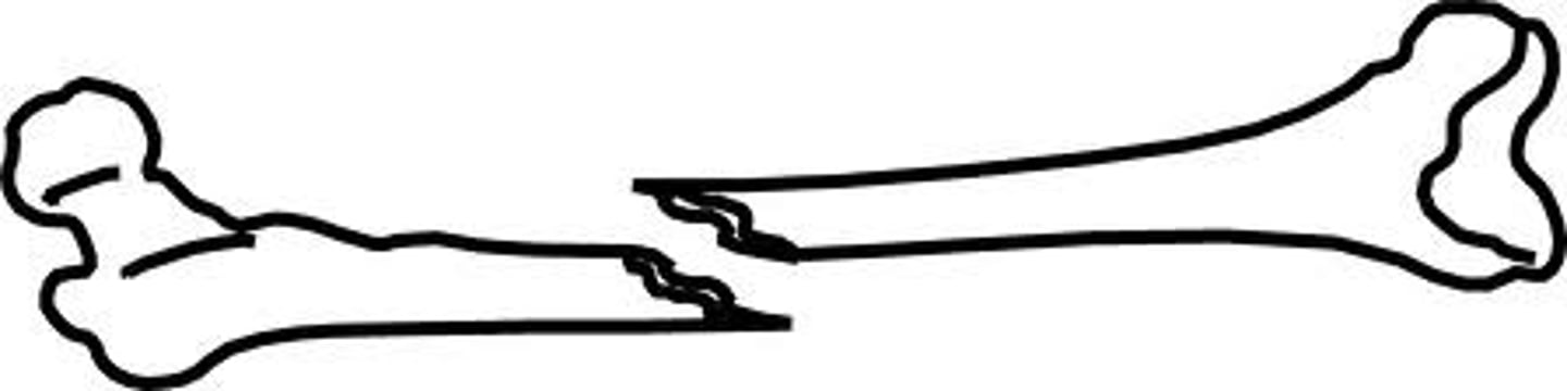 <p>kaputt gehen (Was! Dein Handy ist schon wieder kaputt (gegangen)?)</p>