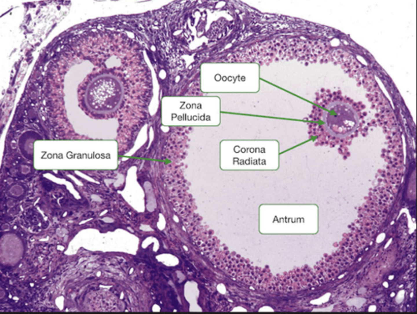 <p>Identify the stage of the follicle</p>