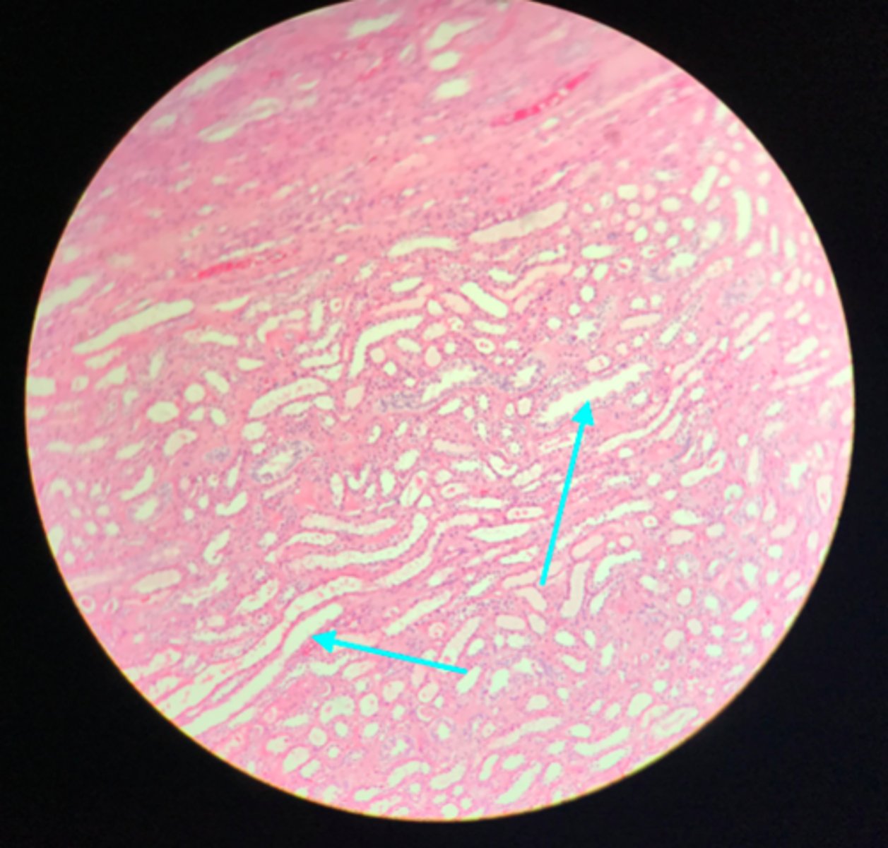 <p>What structure of the kidney are the blue arrows pointing at?</p>