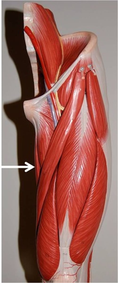 <p>Origin: Pubic bone</p><p>Insertion: Medial shaft of tibia </p><p>Action: Hip adduction, medial rotation, knee flexion </p>