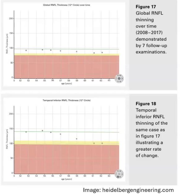 <p>monitoring change on oct </p>