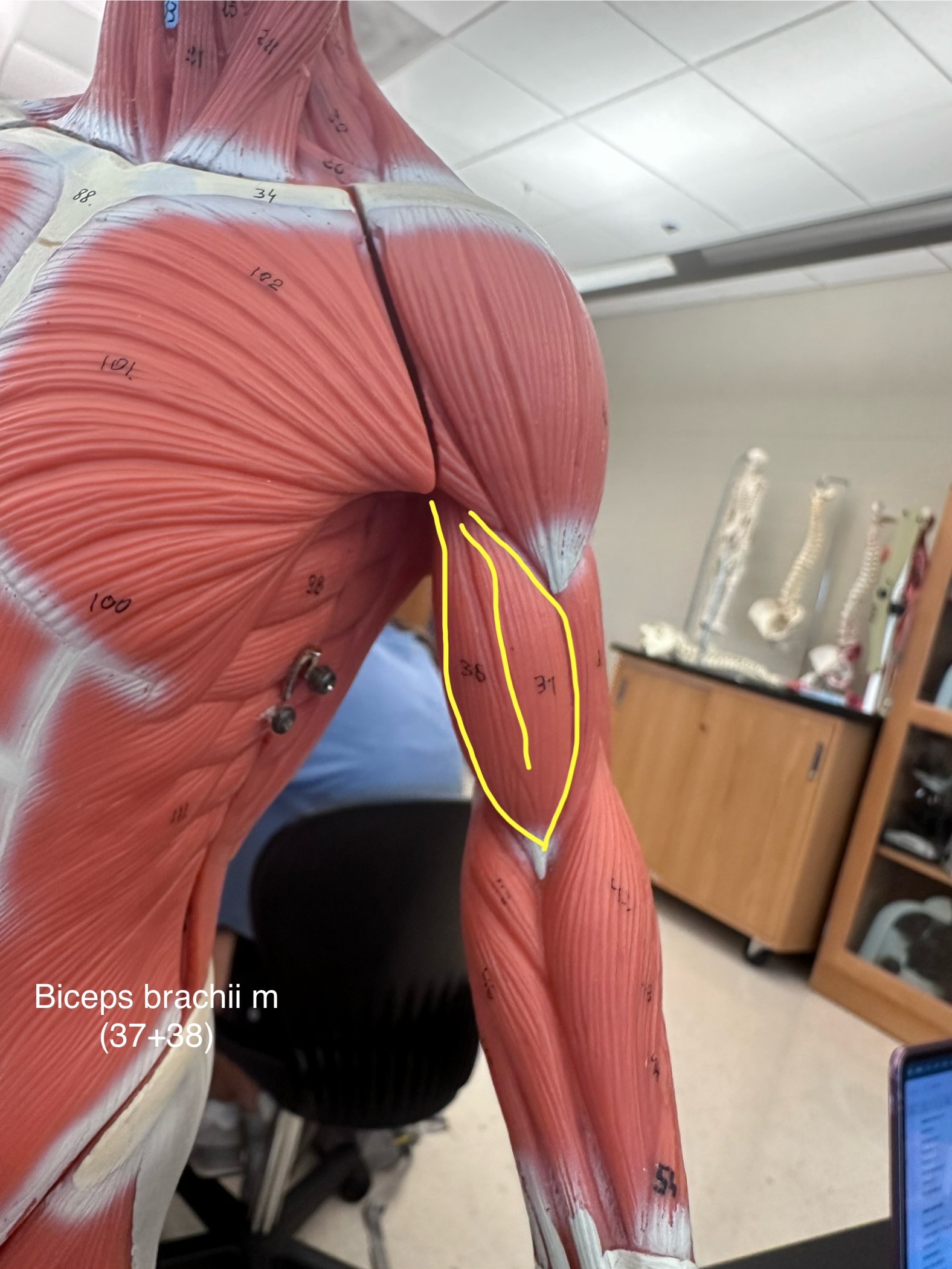 <p>Biceps brachii muscle. This muscle flexes and supinates the forearm.</p><ul><li><p>The origin is at the coracoid process</p></li><li><p>The insertion is the common tendon into the radial tuberosity.</p></li></ul>