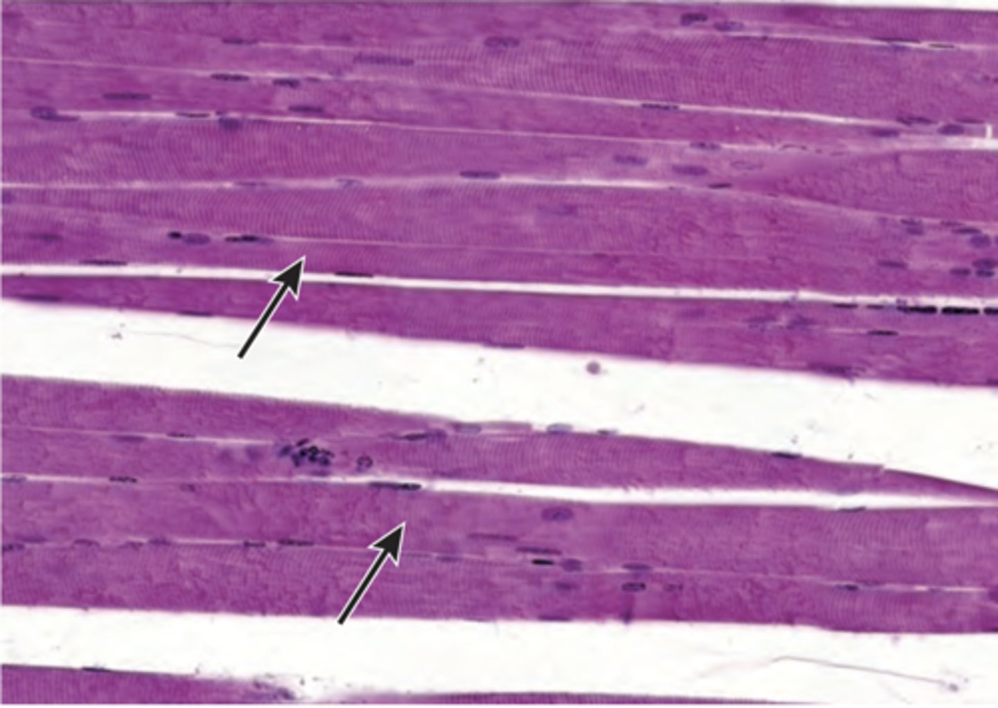 <p>A portion of the sartorius muscle, obtained at autopsy, is prepared using routine H&amp;E staining and examined by light microscopy (shown in the image). Identify the structures indicated by the arrows.</p><p>(A) Muscle fascicles</p><p>(B) Muscle fibers</p><p>(C) Myofibrils</p><p>(D) Myofilaments</p><p>(E) Sarcomeres</p>