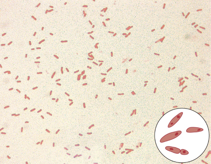<ul><li><p class=""><strong>Gram-negative rod</strong></p></li><li><p class=""><strong>Unusual bipolar staining</strong></p></li><li><p class=""><strong>Capsules</strong></p></li></ul><p></p>