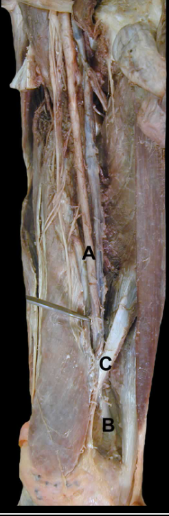 <p>A</p>