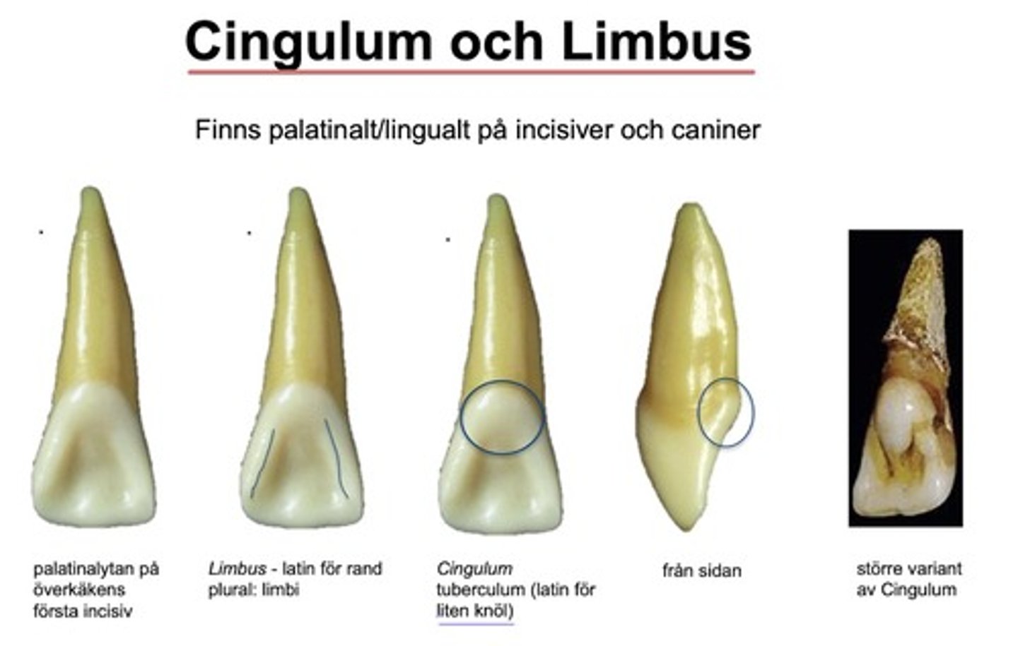 <p>- Finns <strong>palatinalt/lingual</strong>t på  <span><strong><u>inciver</u></strong></span><strong> och </strong><span><strong><u>caniner</u></strong></span></p><p>- Är en <em>tuberculum</em> (=liten knöl) som ses som en knöl bakifrån, men som också fortsätter approximant</p>