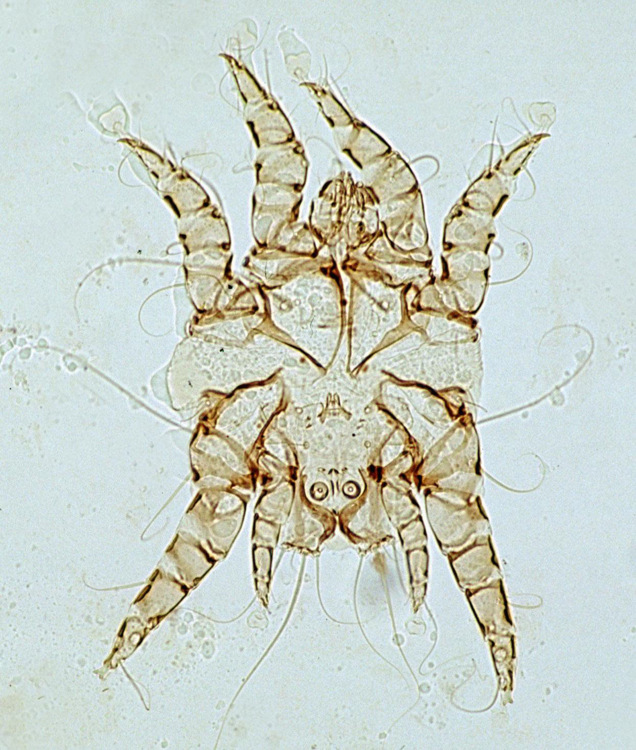 <p>Otodectes - ear mites. lives in the ear canals of animals, feeding on skin debris and ear wax. itching, head shaking, and dark, crumbly ear discharge.</p>