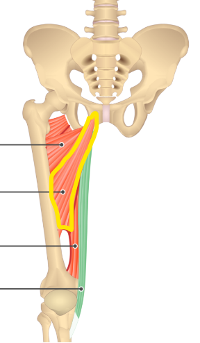 term image