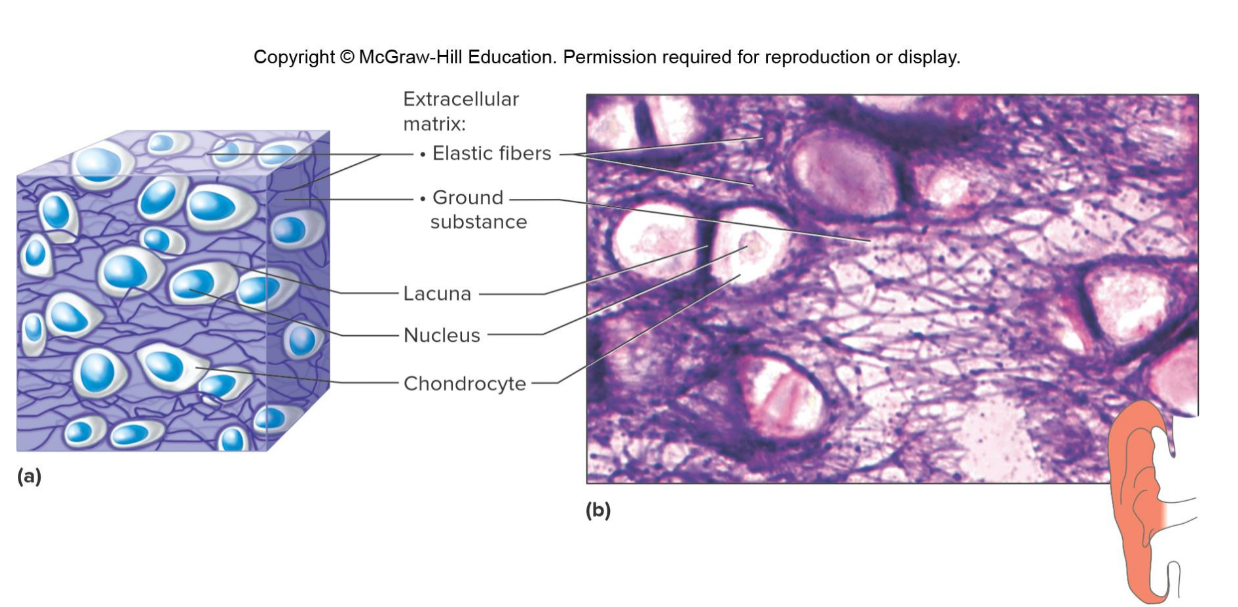 <p>Which cartilage is this </p>