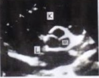 <p>M?</p>