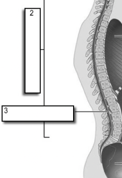 <p>vertebral cavity</p>