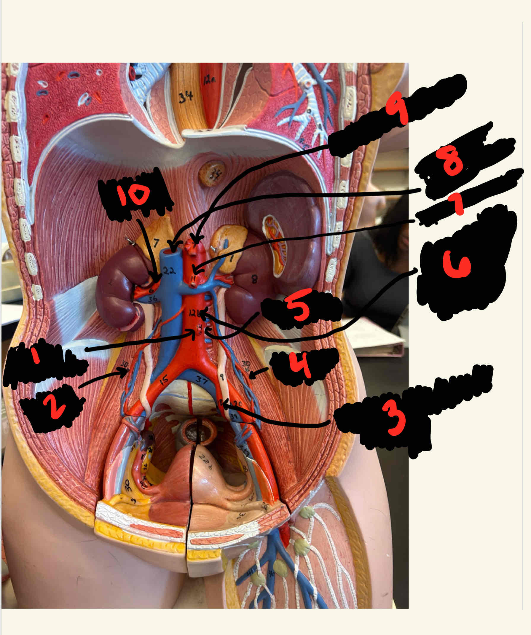 <p>What is the structure labeled 6</p>