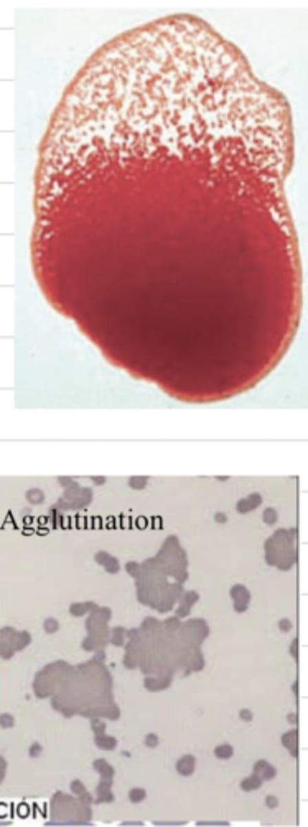 <p>in what type of anemia is agglutination typical?</p>