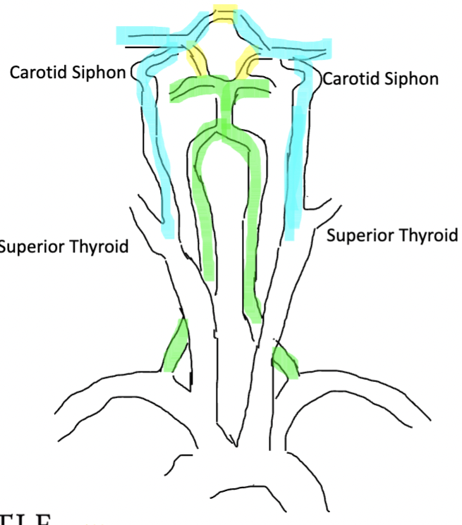 <p>What types of circulation is being shown, when would you use them? </p>