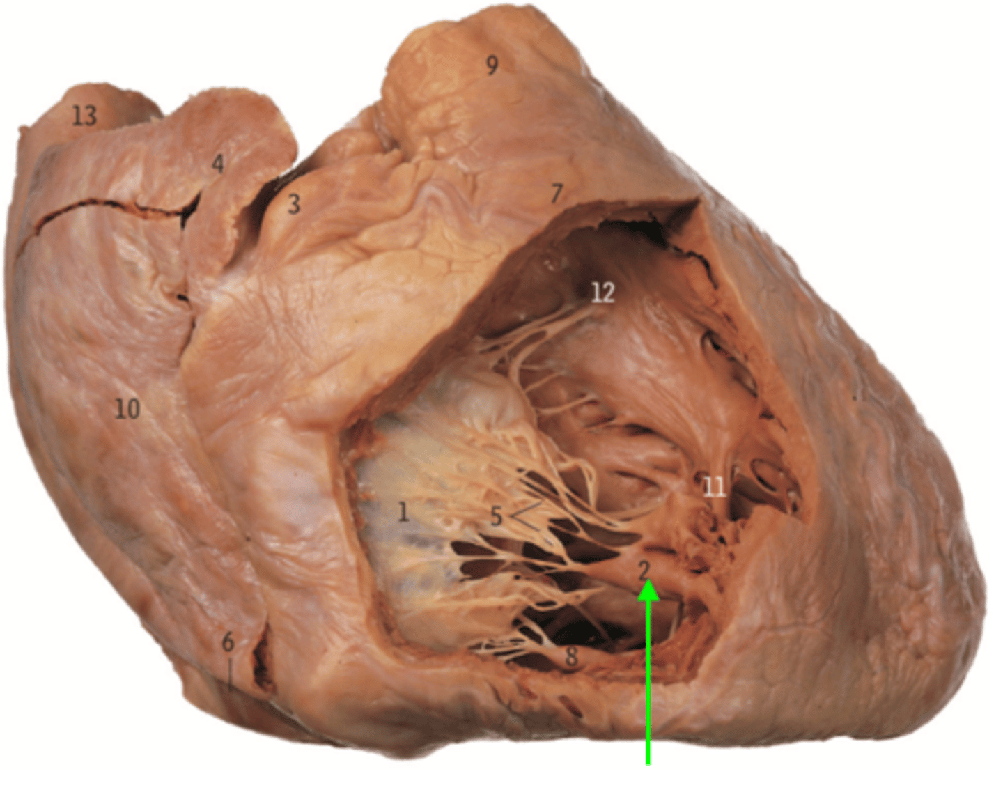 <p>Name the Muscle of the Right Ventricle</p>