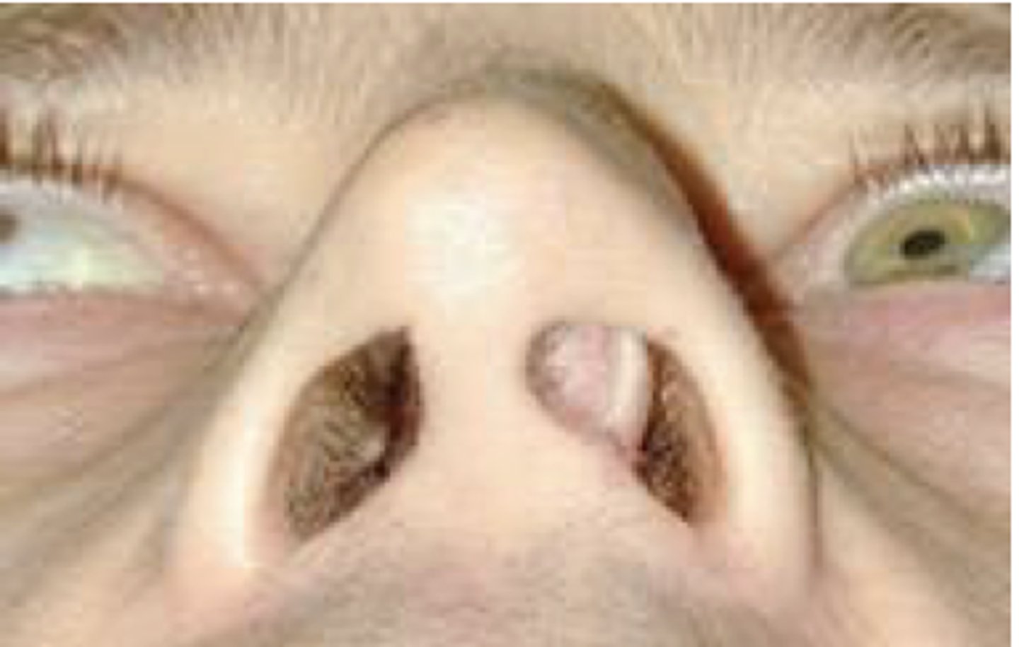 <p>Birth injuries</p>