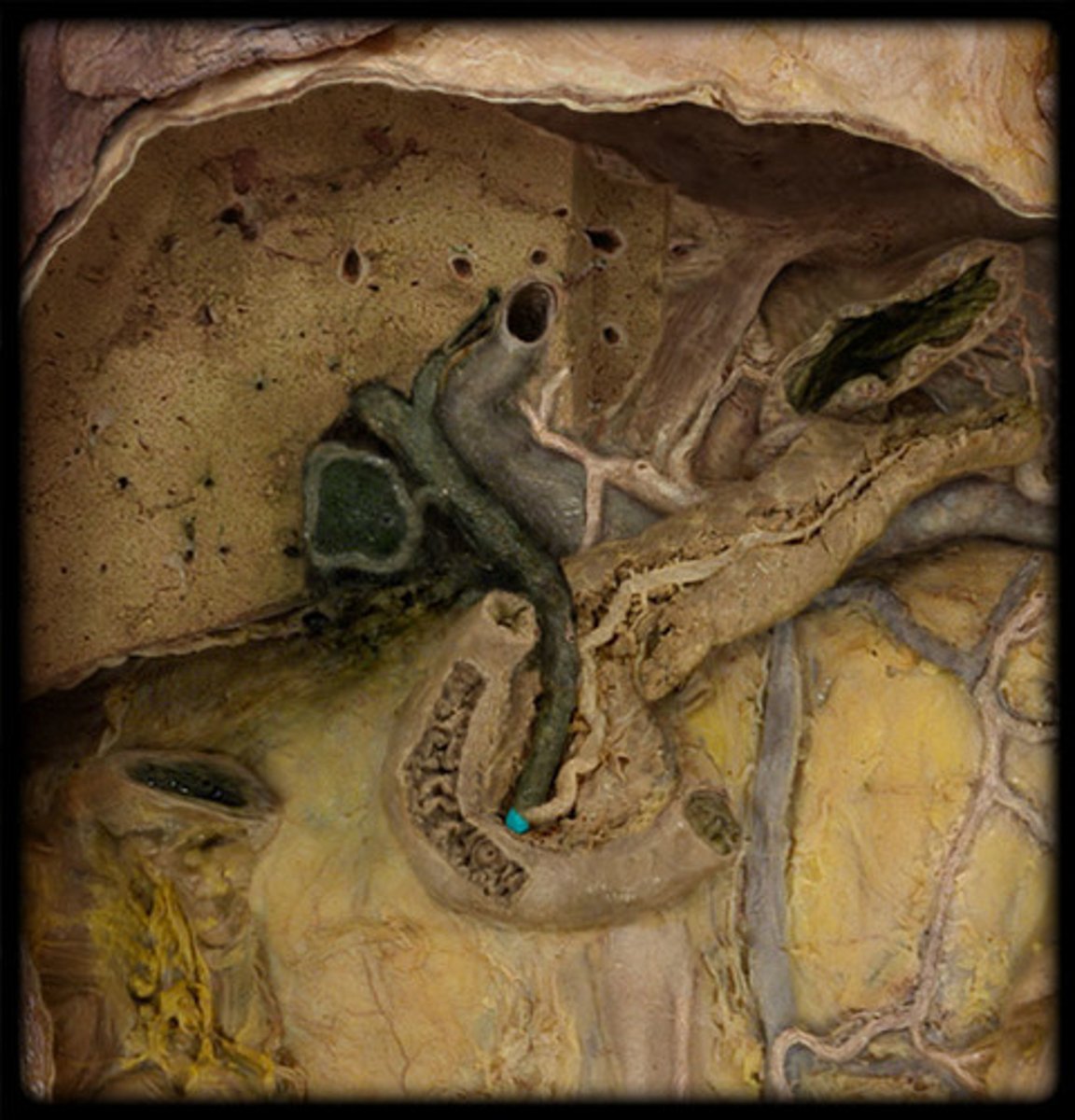 <p>end of bile duct</p>