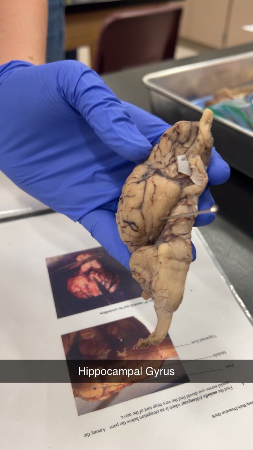 <p>hippocampal gyrus</p>