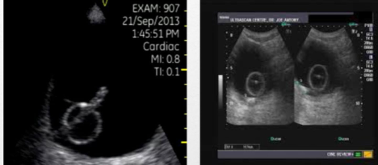 <p>bladder</p>