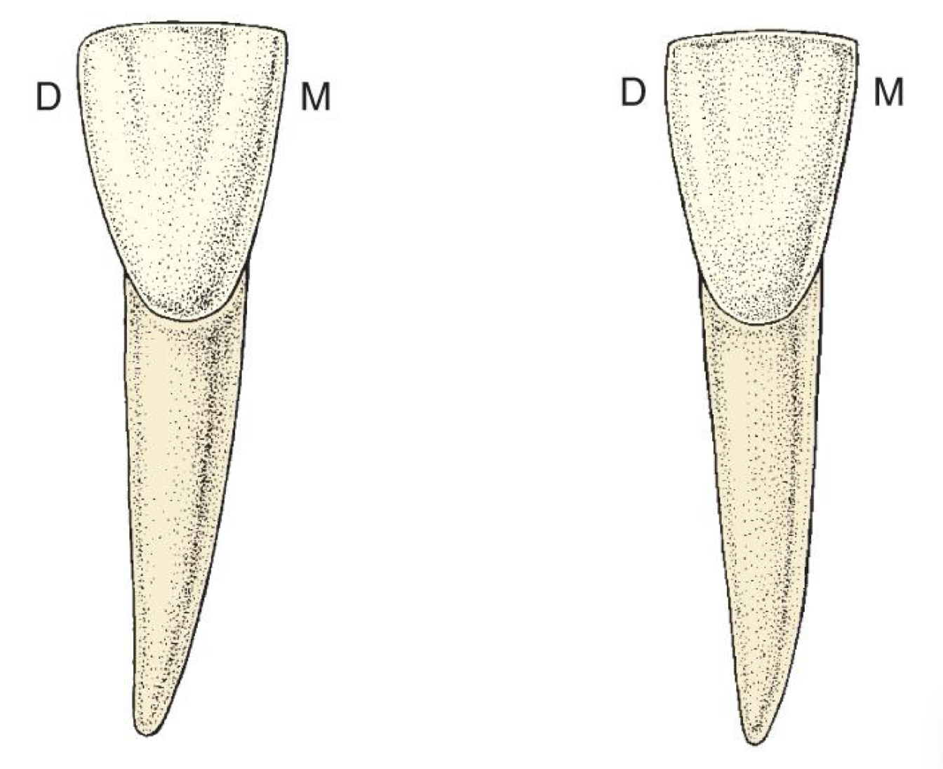 <p>No, distoincisal is more rounded (like maxillary centrals)</p>