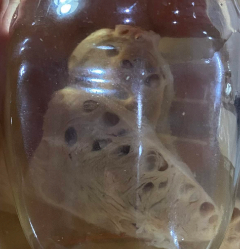 <p>name of larval stage and of which parasite? give the organ.</p>