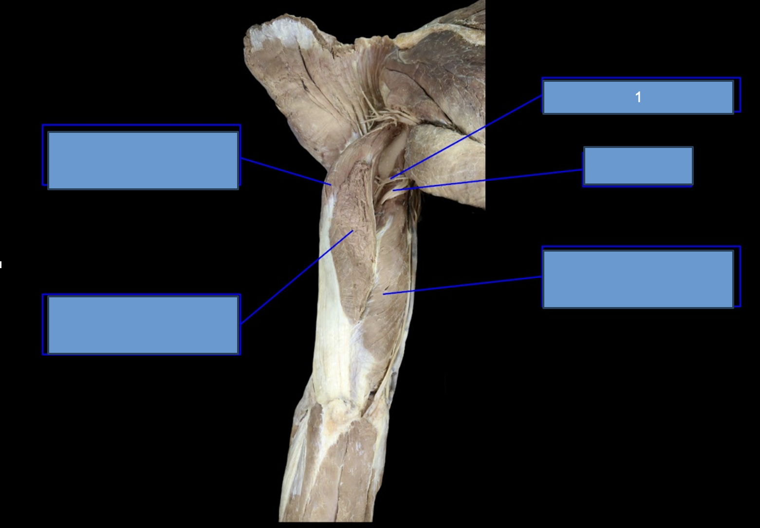 <p>What artery is this</p>