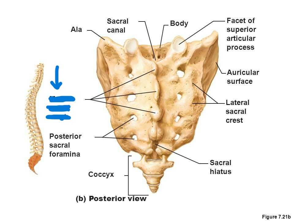 <p>What part of sacrum?</p>