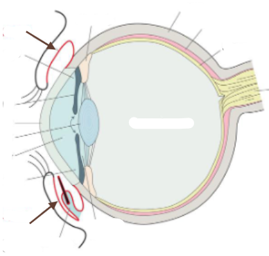 term image