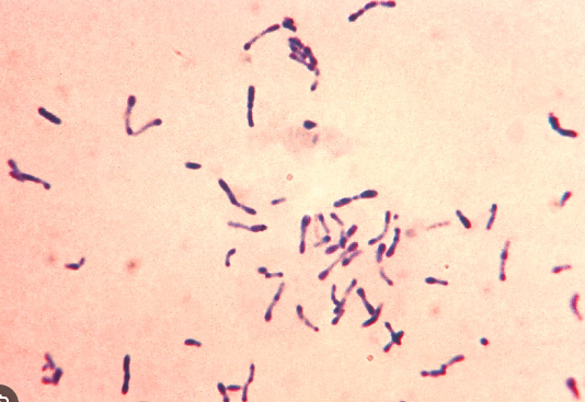 <p>pleomorphic, non-spore, GPR; may have club-shape or striations; V or L formations, palisading</p><p>widely found in soil, water</p><p>normal flora of human skin &amp; mucous membranes </p>