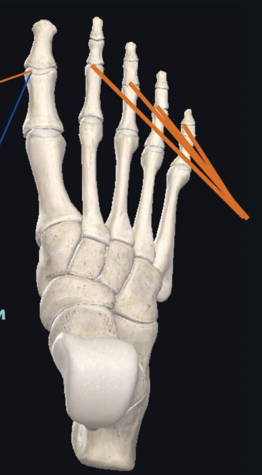 <p>What is this joint? </p>