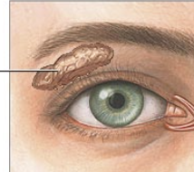 <p>What is this gland?</p>