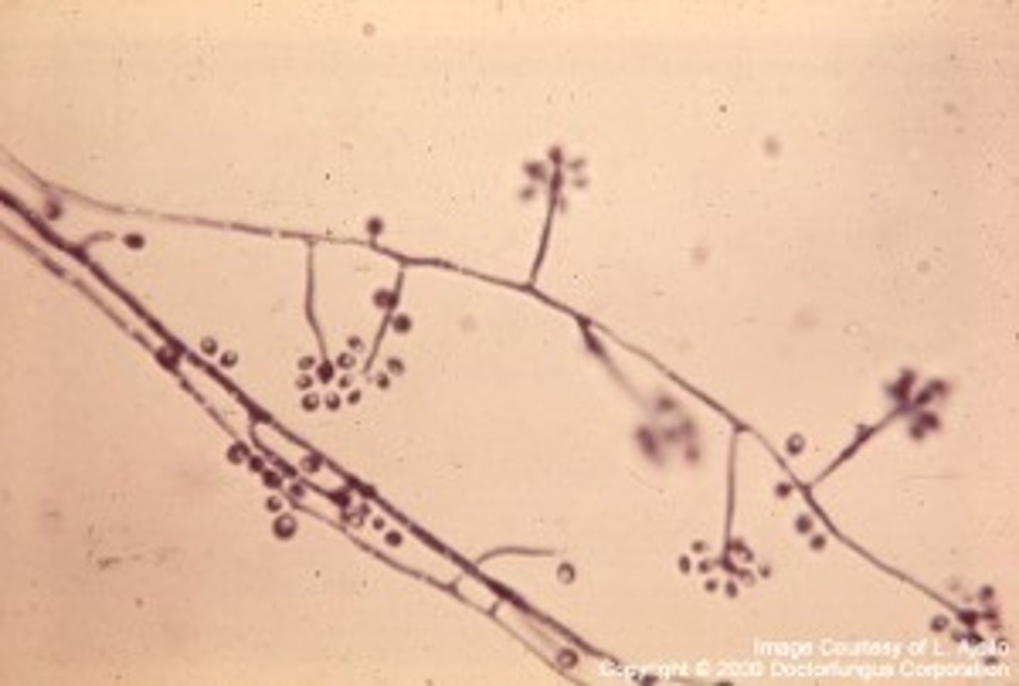 <p>(Mold form)</p>