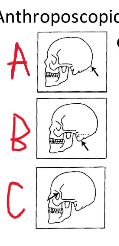 <p>Vad är A)?</p>
