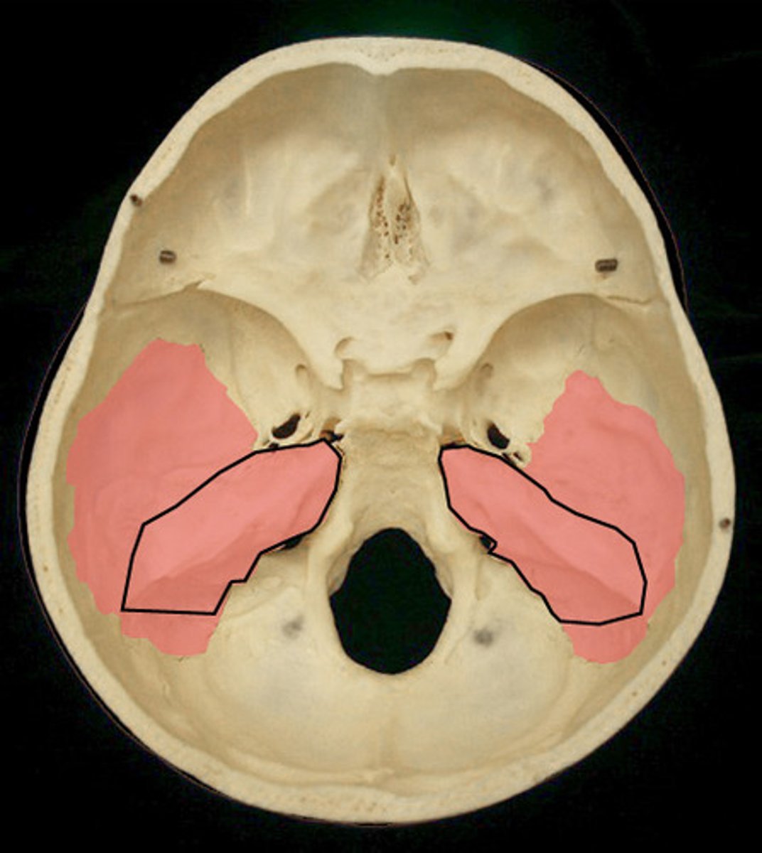 <p>refers to portion of the bone</p>