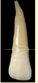 <p><mark data-color="yellow" style="background-color: yellow; color: inherit">maxillary lateral incisors #7 and #10; cross section</mark></p>