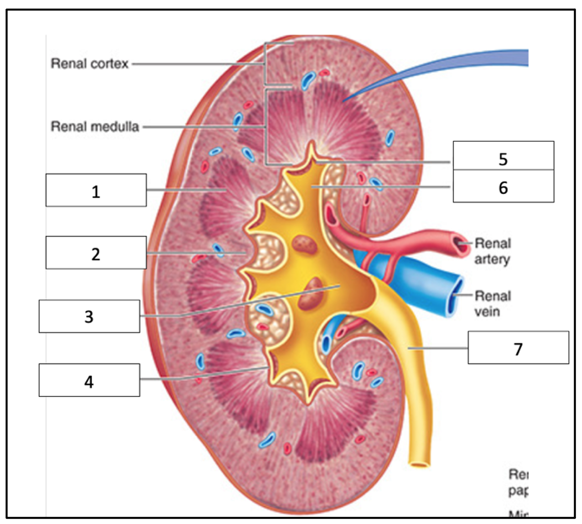 Label the following diagram:

