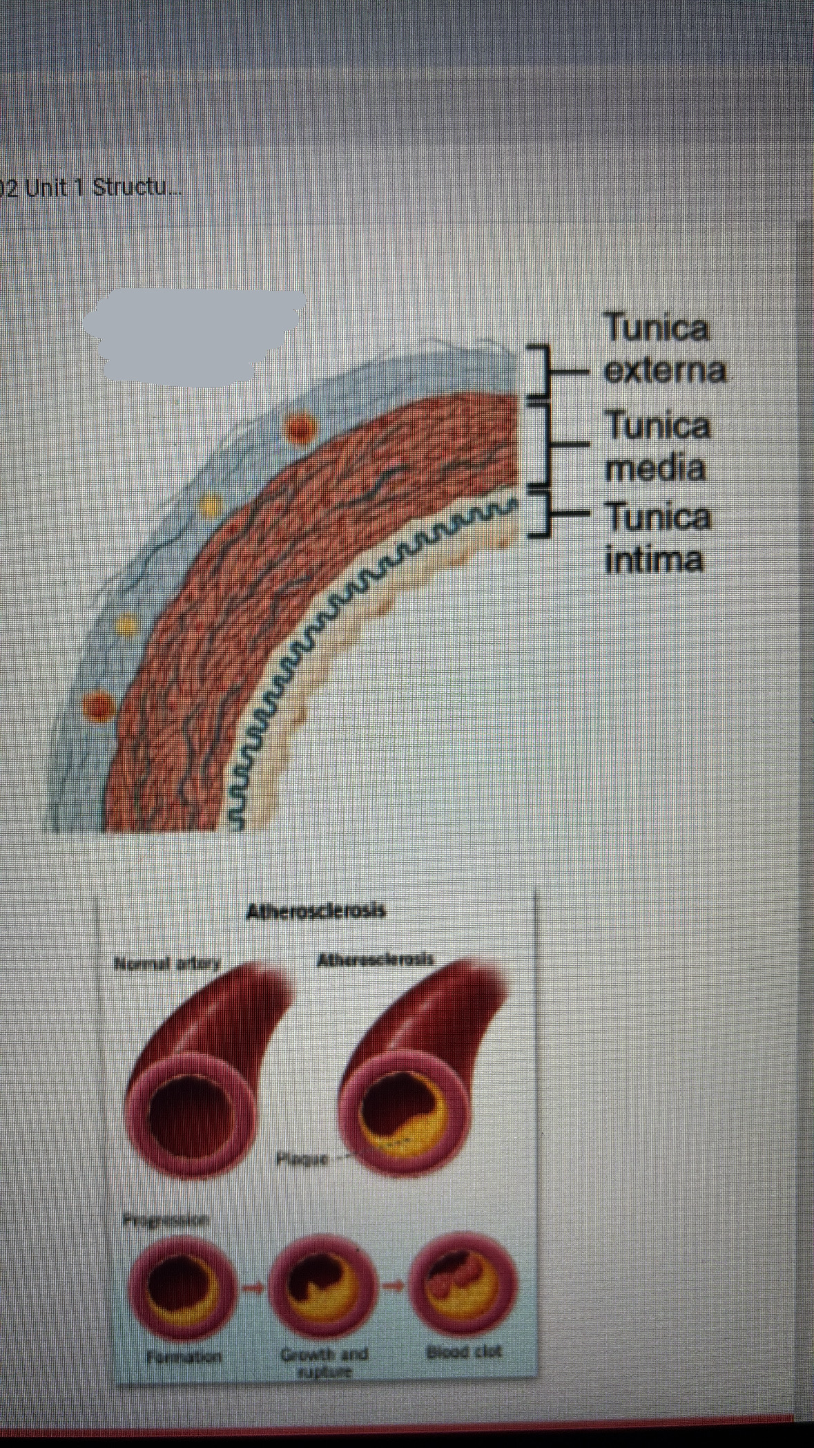 <p>intermediate diameter</p><p>includes arteries that simply organs</p><p>tunica media is mostly smooth muscle</p><ul><li><p>allows for nervous and endocrine control of blood flow (vasoconstriction vasodilation)</p></li></ul><p></p>
