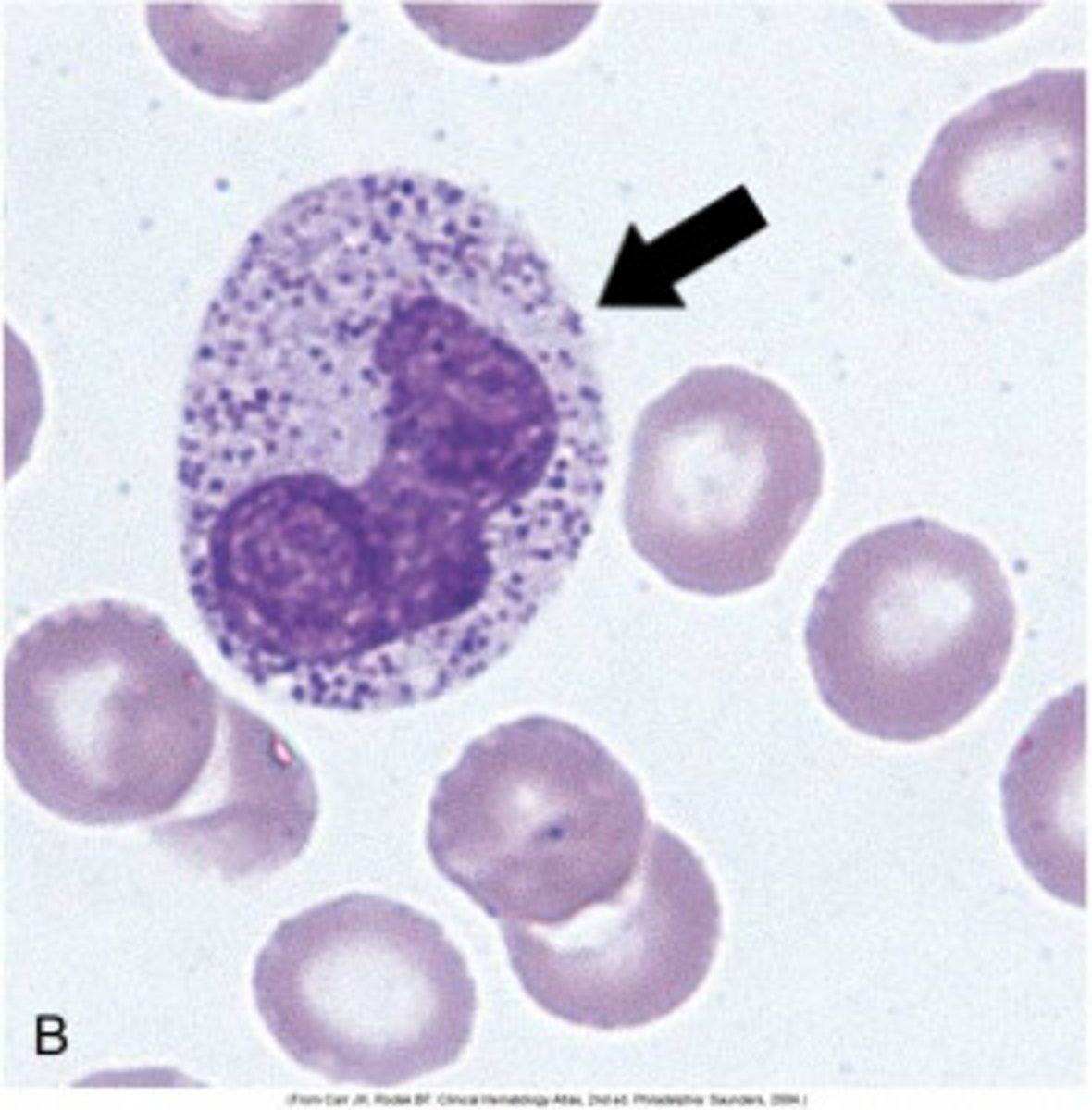 <p>What is this reactive change in neutrophils?</p>