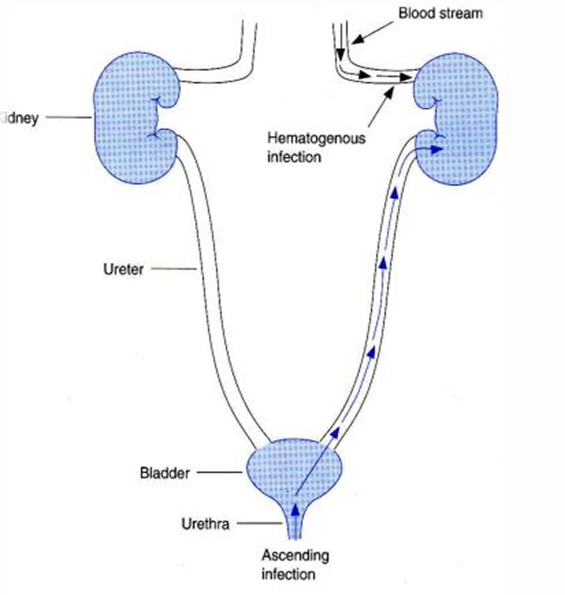 <p>2 routes:</p><p>→ Ascending = via urethra<br>→ Descending = Hematogenously </p>