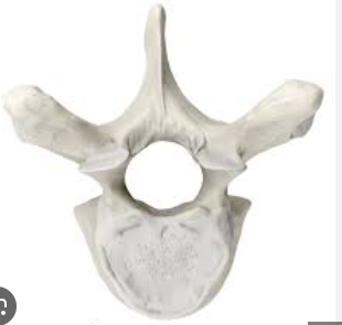 <p>What is the name of this bone?</p>