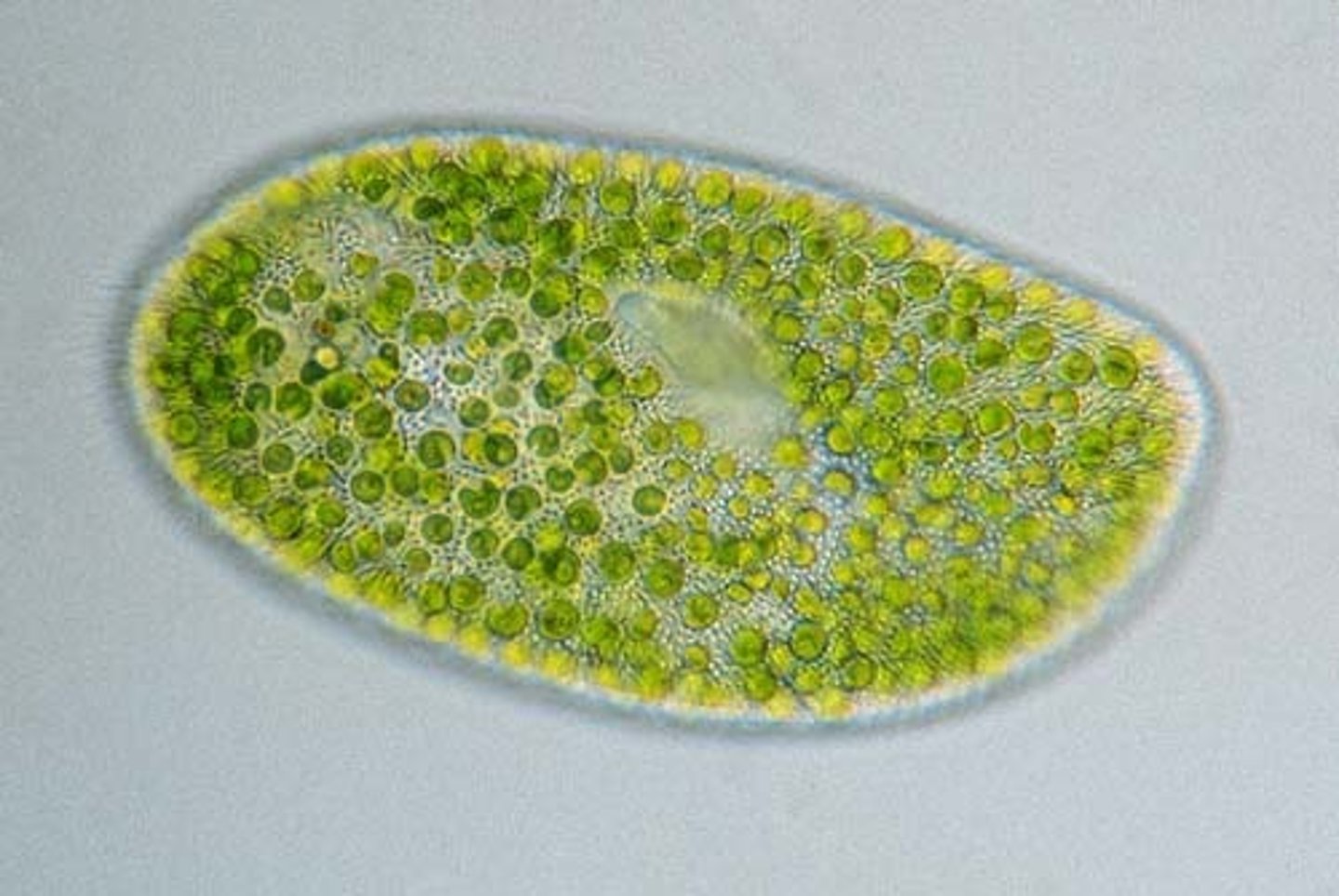 <p>- Unicellular and multicellular</p><p>- Have nuclei</p><p>- May contain chloroplast</p>