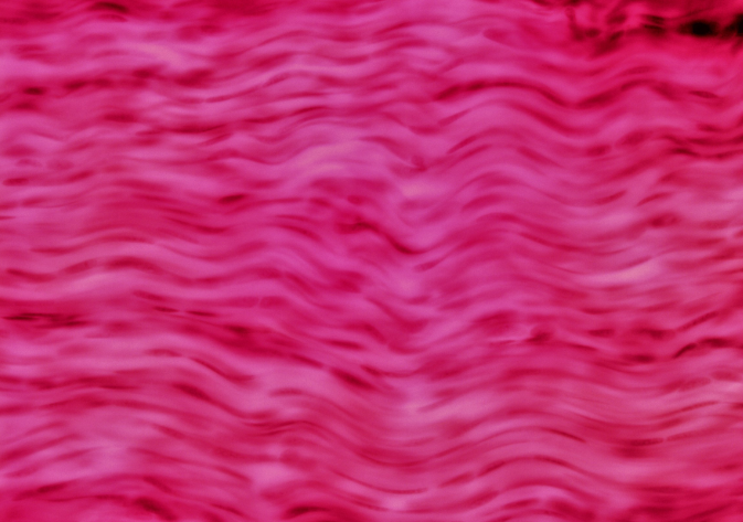 <p>A type of connective tissue organized into parallel collagen fibers, providing tensile strength and support, commonly found in tendons and ligaments. </p>