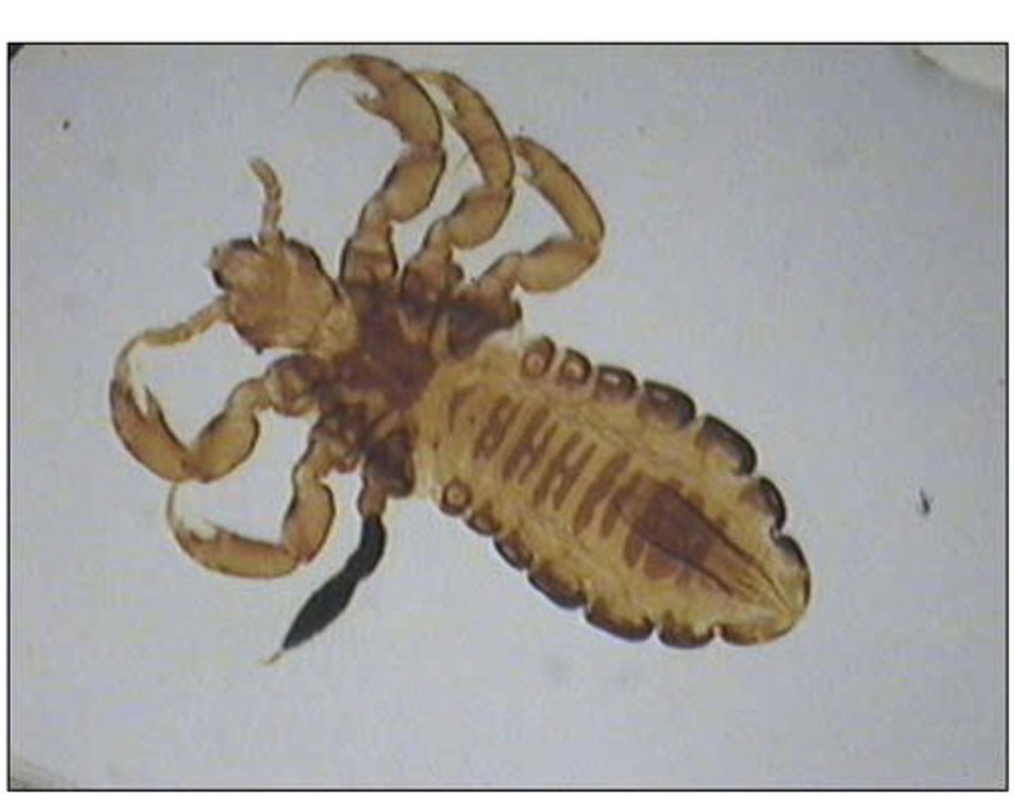 <p>6 legs</p>