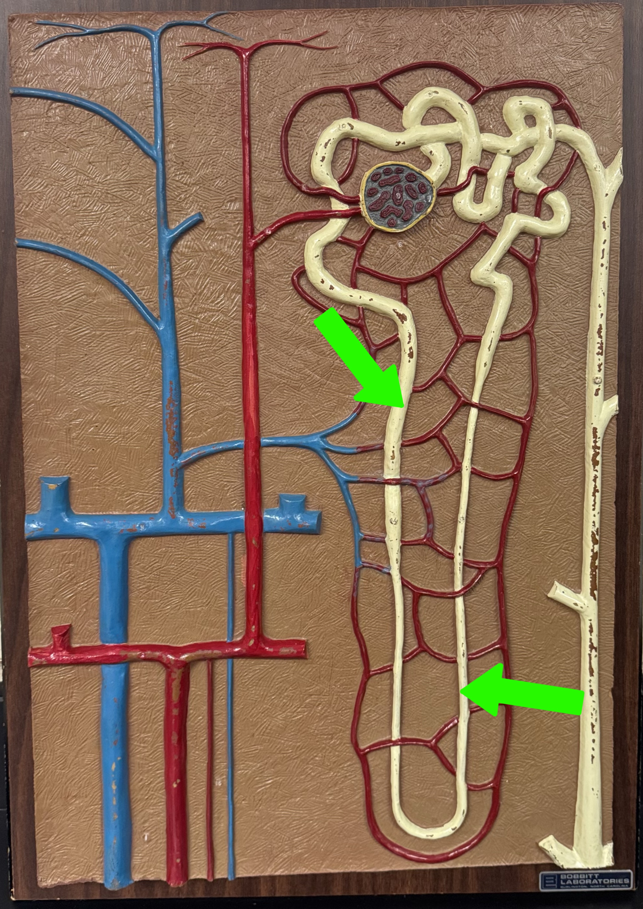 <p>What are these parts of the nephron?</p>