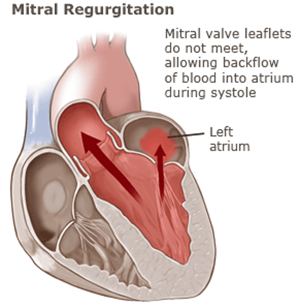 <p>permits back-flow of blood from the left ventricle into the left atrium during systole</p>