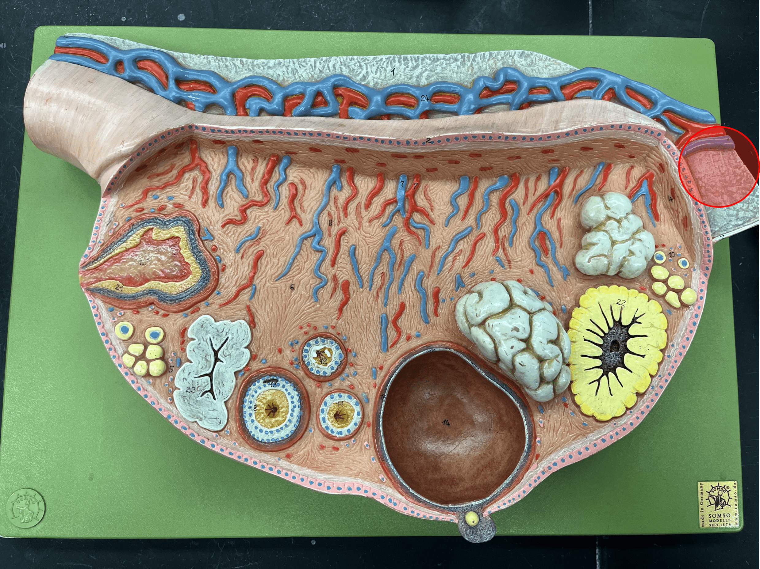 • One of the ligaments holding the female reproductive system.

• Attaches the superior lateral side of each ovary to the pelvic wall.

• Contains ovarian aa. and vv.