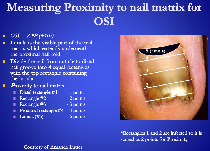 <p>P (max of 5 points) = proximity to nail matrix</p><ul><li><p>1 point – <span><strong>[...]</strong></span></p></li><li><p>2 point – <span><strong>[...]</strong></span></p></li><li><p>3 point – <span><strong>[...]</strong></span></p></li><li><p>4 point – <span><strong>[...]</strong></span></p></li><li><p>5 points – <span><strong>[...]</strong></span>&nbsp;</p></li></ul><p></p>