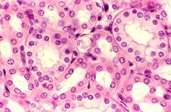 <p>What epithelial tissue is this?</p>